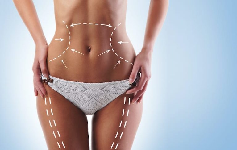 Rasvaimu areng ja võidukäik 2 Rasvaimu areng ja võidukäik 1