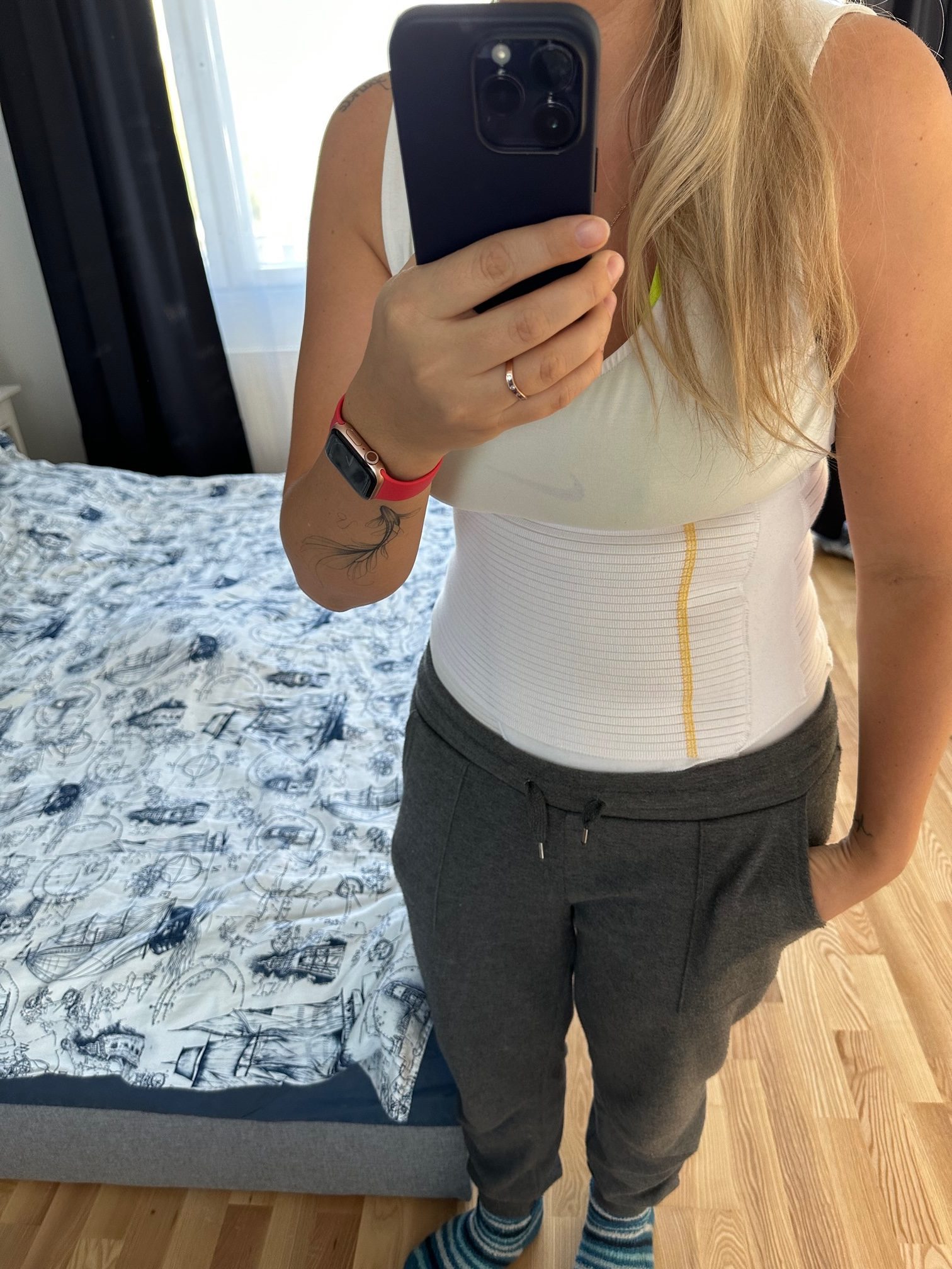 Минна-Май: Абдоминопластика даёт просто замечательный результат и гарантирует невероятное повышение самооценки! 4 kõhuplastika tummy tuck