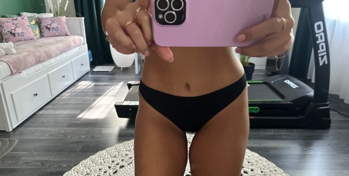 Siiri: "Peale operatsiooni, kui esimest korda oma kõhtu nägin, hakkasid õnnepisarad voolama, sest kõht oli nii ilus!" 1